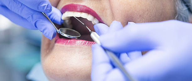 Best Emergency Dental Care for Sports Injuries in Rochester Institute Of Technology, NY